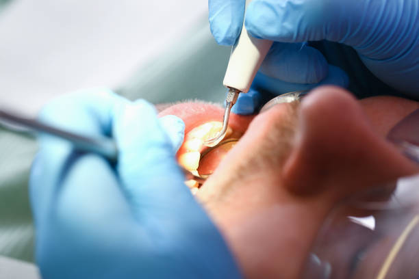 Best Emergency Tooth Extraction in Bushyhead, OK